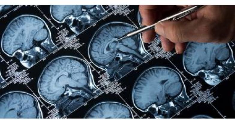 അമീബിക് മസ്തിഷ്‌ക ജ്വരം: സംസ്ഥാനത്ത് ഒരാള്‍ക്കൂടി മരിച്ചു