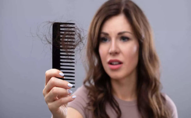 Dandruff And Hair Fall: Hair Fall : ഈ കാര്യങ്ങൾ പിന്തുടർന്നാൽ താരൻ മൂലമുള്ള മുടി കൊഴിച്ചിൽ തടയാം - how to prevent hair fall caused by dandruff