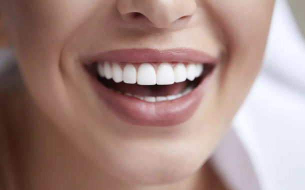 How To Get Rid Of Yellow Teeth: പല്ലുകളുടെ മഞ്ഞനിറം അകറ്റാൻ ഇതാ ചില സൂപ്പർ ടിപ്സ് - simple tips to get rid of yellow teeth